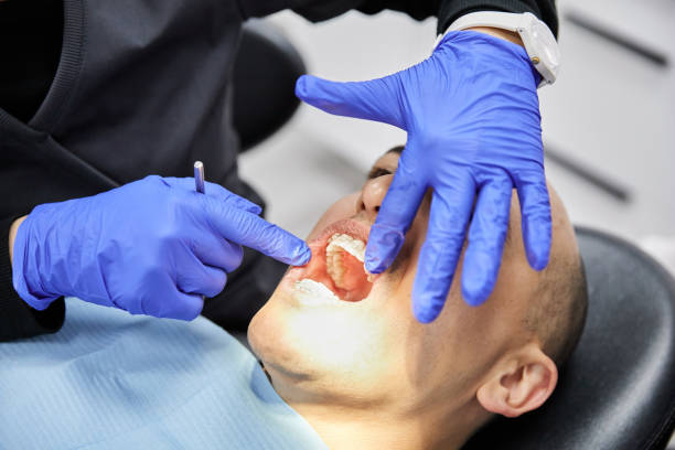 Best Emergency Dental Filling Replacement  in Madison Center, CT